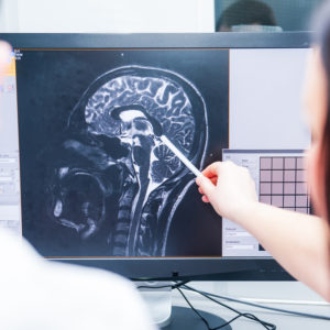 brain injury